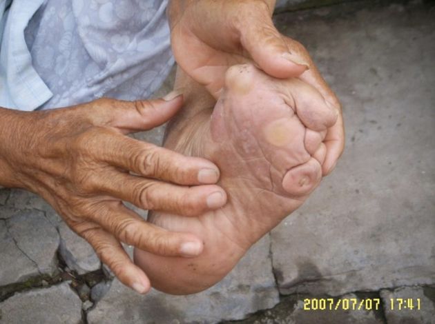 binding erotic foot Chinese